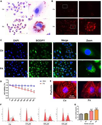 Activation of the Nrf2/ARE signaling pathway protects against palmitic acid-induced renal tubular epithelial cell injury by ameliorating mitochondrial reactive oxygen species-mediated mitochondrial dysfunction